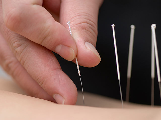 akupunktur-tcm-biffiger-st-niklaus